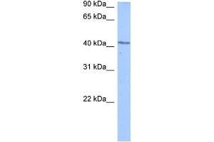 WB Suggested Anti-DCP2 Antibody Titration:  0.