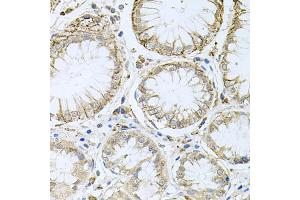 Immunohistochemistry of paraffin-embedded human stomach using HPS1 antibody. (HPS1 anticorps)