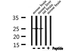 Western blot analysis of extracts from mouse brain, mouse liver, rat brain, using RND2 Antibody.