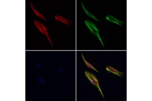 Ribophorin I Antibody staining Hela cells by IF/ICC. (RPN1 anticorps  (C-Term))