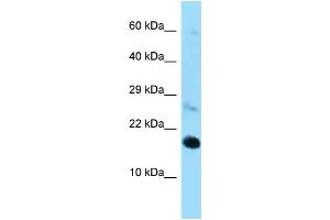 Western Blotting (WB) image for anti-Ribosomal Protein L22 (RPL22) (C-Term) antibody (ABIN2789541) (RPL22 anticorps  (C-Term))