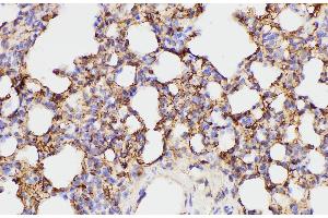 Immunohistochemistry of paraffin-embedded Rat lung using FGA Polycloanl Antibody at dilution of 1:100 (FGA anticorps)
