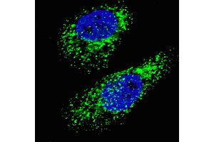 Fluorescent image of  cells stained with LC3 (G8A)  antibody. (MAP1LC3A anticorps  (AA 91-117))