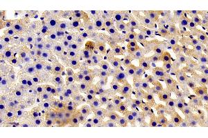 Detection of AZIN1 in Rat Liver Tissue using Polyclonal Antibody to Antizyme Inhibitor 1 (AZIN1) (Antizyme Inhibitor 1 anticorps  (AA 1-280))