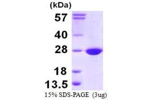 SDS-PAGE (SDS) image for COX4 Neighbor (COX4NB) (AA 1-210) protein (His tag) (ABIN667539)