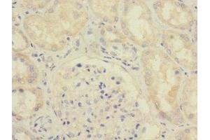 Immunohistochemistry of paraffin-embedded human kidney tissue using ABIN7166095 at dilution of 1:100 (SAV1 anticorps  (AA 1-210))