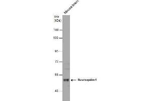 WB Image Mouse tissue extract (50 μg) was separated by 7.