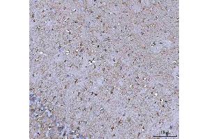 IHC analysis of COX5B using anti-COX5B antibody (ABIN7598975).