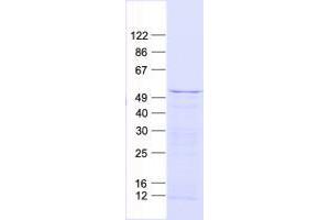 Validation with Western Blot