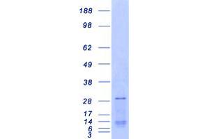 Validation with Western Blot