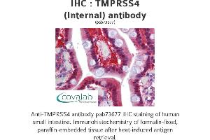 Image no. 1 for anti-Transmembrane Protease, serine 4 (TMPRSS4) (Internal Region) antibody (ABIN1740176) (TMPRSS4 anticorps  (Internal Region))