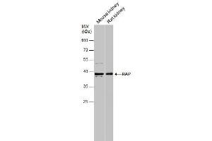 WB Image Various tissue extracts (50 μg) were separated by 10% SDS-PAGE, and the membrane was blotted with RAP antibody [N1C3] , diluted at 1:1000. (LRPAP1 anticorps  (Center))