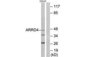 Western blot analysis of extracts from COLO cells, using ARRD4 Antibody. (ARRD4 anticorps  (AA 127-176))