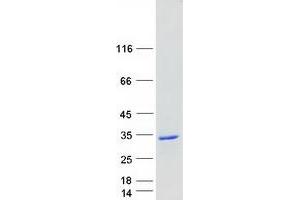 Validation with Western Blot