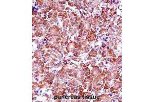 Immunohistochemistry (IHC) image for anti-Matrix Metallopeptidase 28 (MMP28) antibody (ABIN2997500)