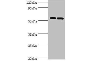 Western blot All lanes: PNPLA2 antibody at 10 μg/mL Lane 1: A431 whole cell lysate Lane 2: Hela whole cell lysate Secondary Goat polyclonal to rabbit IgG at 1/10000 dilution Predicted band size: 56, 20 kDa Observed band size: 56 kDa (PNPLA2 anticorps  (AA 265-504))
