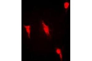 Immunofluorescent analysis of PRMT2 staining in Hela cells. (PRMT2 anticorps)