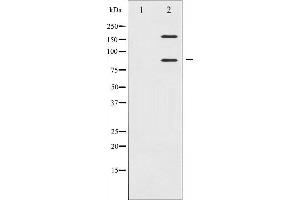 Western blot analysis of IGF1R expression in Insulin treated 293 whole cell lysates,The lane on the left is treated with the antigen-specific peptide. (IGF1R anticorps  (C-Term))