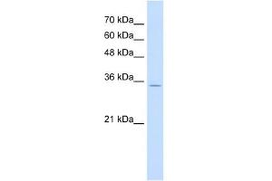 RNF39 antibody used at 1 ug/ml to detect target protein.