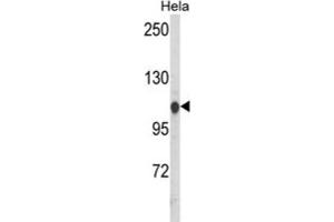 Western Blotting (WB) image for anti-Heat Shock 70kDa Protein 4-Like (HSPA4L) antibody (ABIN3003894)