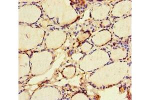 Immunohistochemistry of paraffin-embedded human thyroid tissue using ABIN7172419 at dilution of 1:100 (VGLL4 anticorps  (AA 43-277))