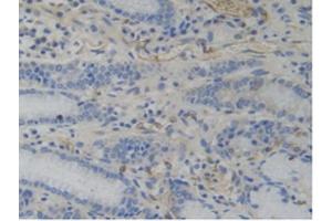 IHC-P analysis of Human Stomach Tissue, with DAB staining. (WARS anticorps  (AA 247-458))