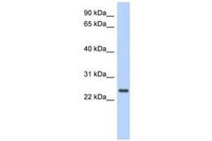 Image no. 1 for anti-Coiled-Coil Domain Containing 70 (CCDC70) (AA 71-120) antibody (ABIN6741256) (CCDC70 anticorps  (AA 71-120))