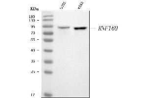 Western blot analysis of RNF169 using anti-RNF169 antibody (ABIN6719530).