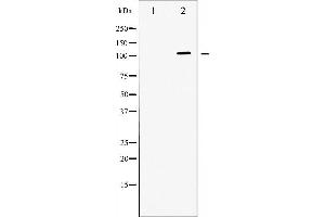 Western blot analysis of ATPase expression in PMA treated 293 whole cell lysates,The lane on the left is treated with the antigen-specific peptide. (ATP1A1 anticorps  (N-Term))