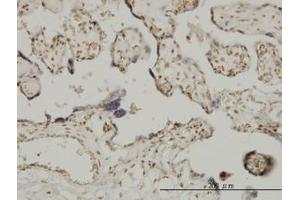 Image no. 1 for anti-Ets Variant 6 (ETV6) (AA 1-453) antibody (ABIN598674) (ETV6 anticorps  (AA 1-453))