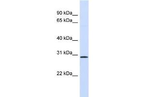 WB Suggested Anti-FGF14 Antibody Titration: 0. (FGF14 anticorps  (Middle Region))