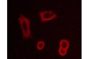 ABIN6267260 staining BT-20 cells by ICC/IF. (EGFR anticorps  (pTyr1016))