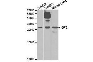 Western Blotting (WB) image for anti-Insulin-Like Growth Factor 2 (IGF2) antibody (ABIN1873163) (IGF2 anticorps)