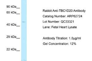 Western Blotting (WB) image for anti-TBC1 Domain Family, Member 20 (TBC1D20) (C-Term) antibody (ABIN2789226) (TBC1D20 anticorps  (C-Term))