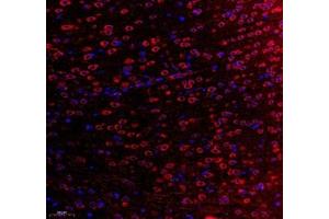 Immunofluorescence of paraffin embedded rat brain using WDR81 (ABIN7076221) at dilution of 1: 700 (200x lens)
