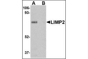 Western blot analysis of LIMP2 in human skeletal muscle tissue lysate with this product at 1 μg/ml in (A) the absence and (B) presence of blocking peptide. (SCARB2 anticorps  (Center))
