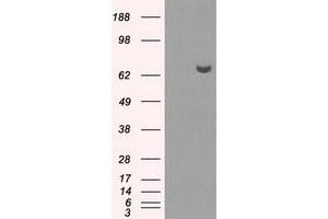 HEK293T cells were transfected with the pCMV6-ENTRY control (Left lane) or pCMV6-ENTRY HDAC10 (Right lane) cDNA for 48 hrs and lysed. (HDAC10 anticorps)