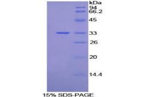 SDS-PAGE analysis of Mouse Vang Like Protein 1 Protein.