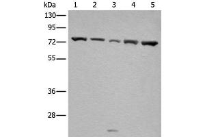 Western blot analysis of Hela and A431 cell Mouse brain tissue HT-29 and Jurkat cell lysates using GARS Polyclonal Antibody at dilution of 1:540 (GARS anticorps)