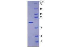 Image no. 3 for Interleukin 7 (IL7) (AA 26-177) (Active) protein (His tag) (ABIN6239759)