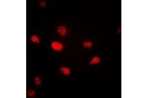 Immunofluorescent analysis of Progesterone Receptor staining in A549 cells. (Progesterone Receptor anticorps)