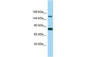 Host: Rabbit Target Name: IQSEC2 Sample Type: MDA-MB-435S Whole Cell lysates Antibody Dilution: 1. (IQSEC2 anticorps  (Middle Region))