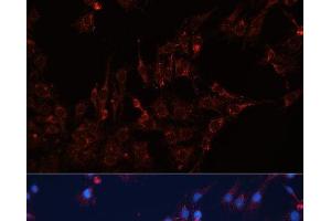 Immunofluorescence analysis of C6 cells using GNAI2 Polyclonal Antibody at dilution of 1:100 (40x lens). (GNAI2 anticorps)