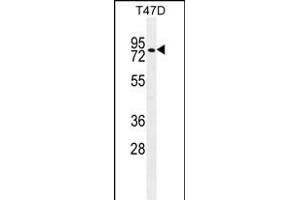 ZNF69 Antibody (C-term) (ABIN655666 and ABIN2845136) western blot analysis in T47D cell line lysates (35 μg/lane). (ZFP69 anticorps  (C-Term))