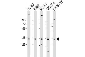 All lanes : Anti-PIGC Antibody (Center) at 1:2000 dilution Lane 1: HL-60 whole cell lysate Lane 2: K562 whole cell lysate Lane 3: MCF-7 whole cell lysate Lane 4: MOLT-4 whole cell lysate Lane 5: SH-SY5Y whole cell lysate Lysates/proteins at 20 μg per lane. (PIGC anticorps  (AA 81-112))