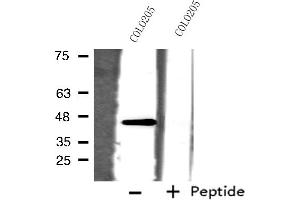Western blot analysis of extracts from COLO205 cells, using ORCTL-2 antibody. (ORCTL-2/SLC22A18 anticorps  (C-Term))