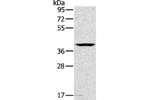 Western blot analysis of Lovo cell, using CAB39 Polyclonal Antibody at dilution of 1:200 (CAB39 anticorps)