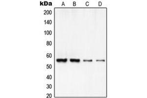 Western blot analysis of RCC2 expression in HeLa (A), A549 (B), MOLT4 (C), NIH3T3 (D) whole cell lysates. (RCC2 anticorps  (C-Term))