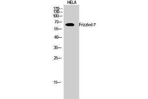 Western Blotting (WB) image for anti-Frizzled Family Receptor 7 (FZD7) (N-Term) antibody (ABIN3175159) (FZD7 anticorps  (N-Term))