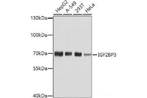 Western blot analysis of extracts of various cell lines using IGF2BP3 Polyclonal Antibody at dilution of 1:1000. (IGF2BP3 anticorps)
